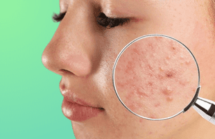 skin disease ayurvedic treatment