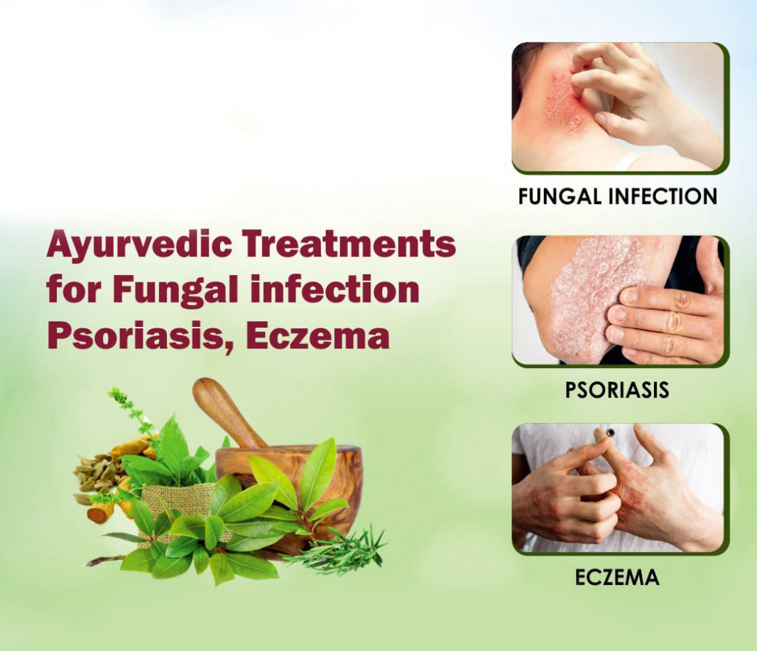 ayurvedic treatments for fungal infection, psoriasis, eczema