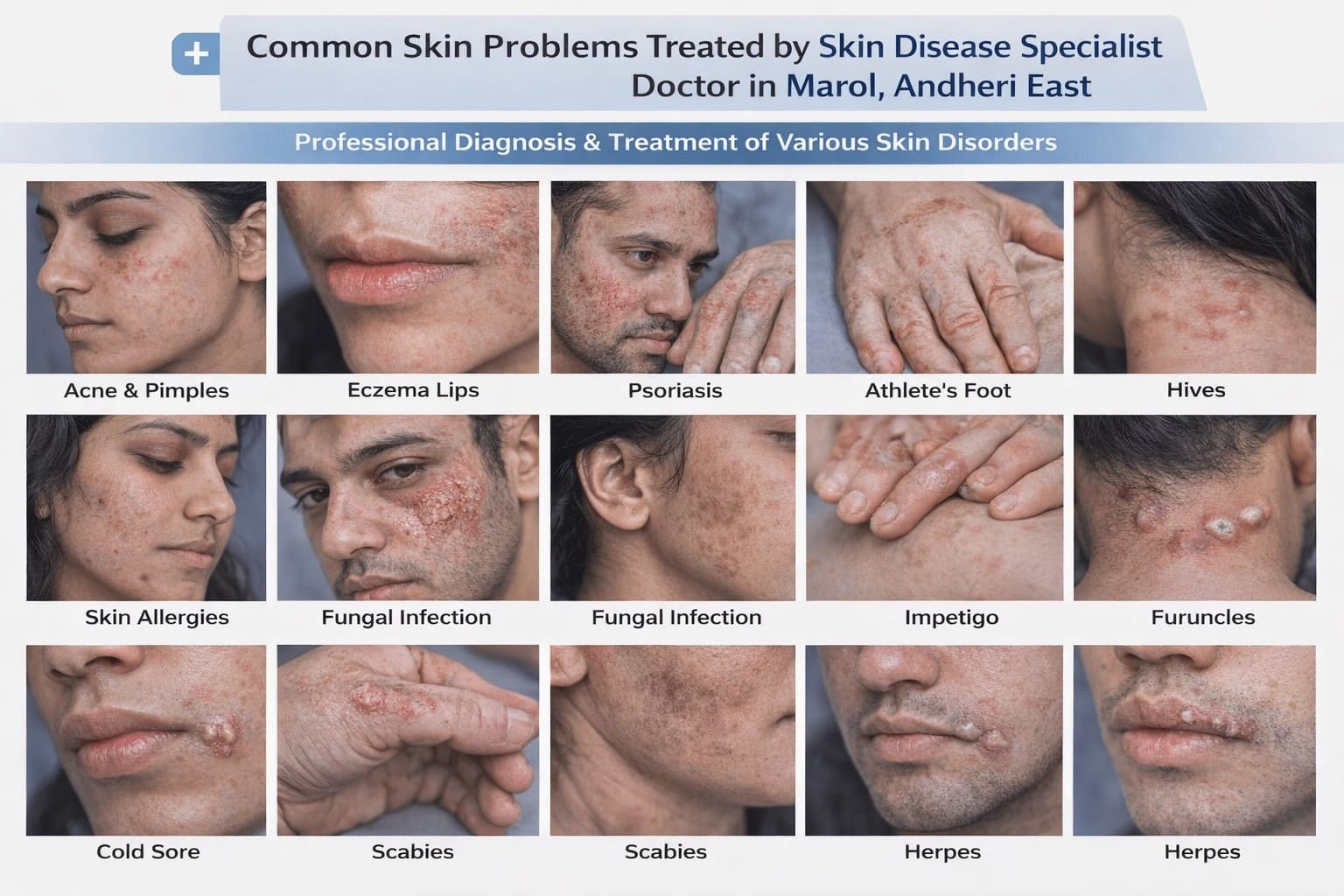 Common skin problems treated by a skin doctor in Marol, Andheri East including acne, eczema, psoriasis, fungal infections, skin allergies, hives, scabies, boils, and cold sores